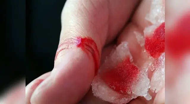 Estas personas no tienen una buena coagulación de la sangre