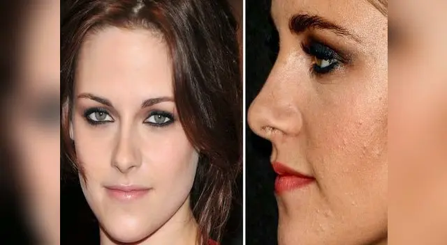 Hay muchos trucos que puedes utilizar para cubrir esos incómodos granitos. Hay muchos trucos que puedes utilizar para cubrir esos incómodos granitos.