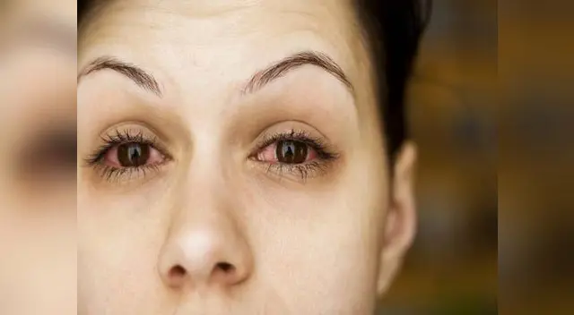 Cuidado con esos productos vencidos pordrían contraer una infección. Cuidado con esos productos vencidos pordrían contraer una infección.