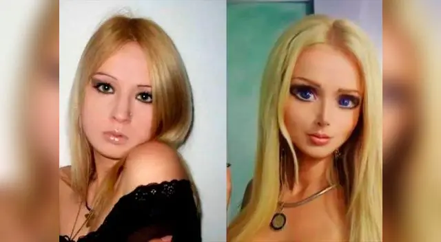 La barbie humana invirtió mucho dinero en sus operaciones La barbie humana invirtió mucho dinero en sus operaciones