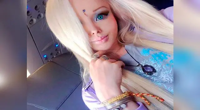 La barbie humana invirtió mucho dinero en sus operaciones La barbie humana invirtió mucho dinero en sus operaciones