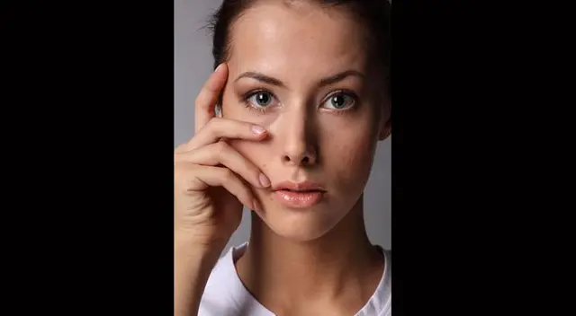 Además si sus progenitores tienen piel grasa es muy probable que Usted lo tenga