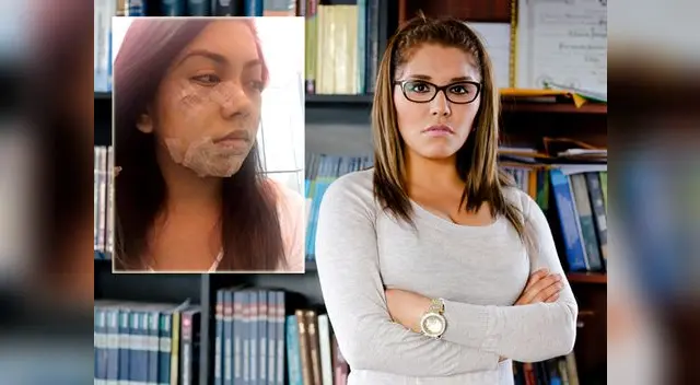 A ella también le desfiguraron el rostro. A ella también le desfiguraron el rostro.