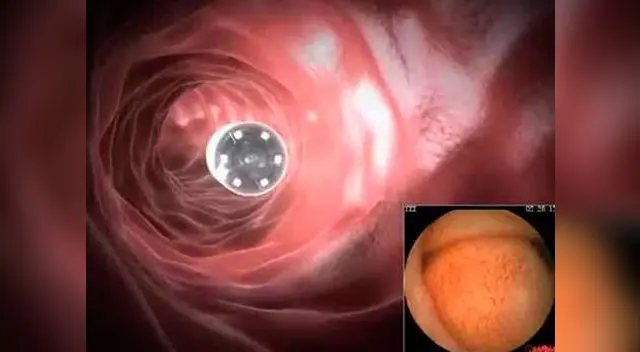 Equipo ayudará a detectar cáncer precozmente Equipo ayudará a detectar cáncer precozmente