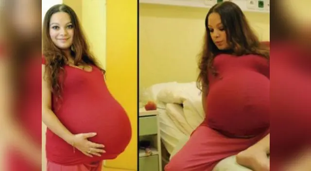 La mujer es víctima de una extraña enfermedad