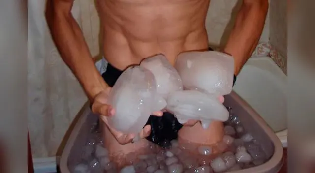 Intenso tratamiento con hielo