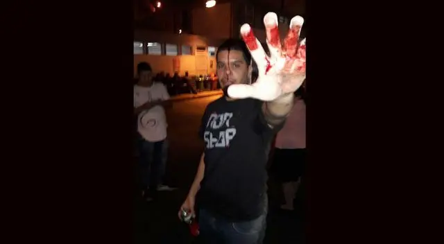 Cantante sufrió brutal ataque