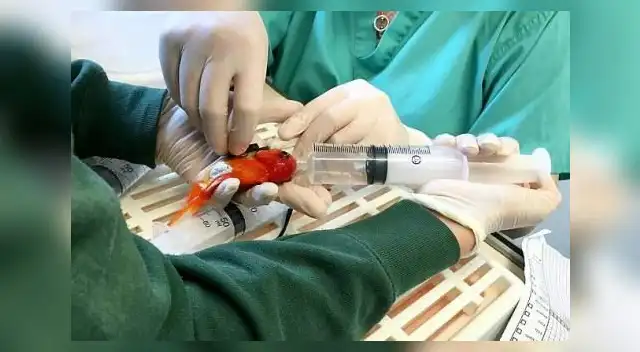  El tumor era casi tan grande como el pez.