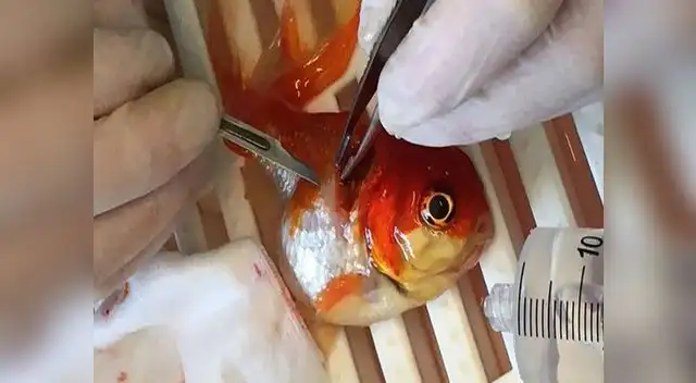 La operación duró 45 minutos.