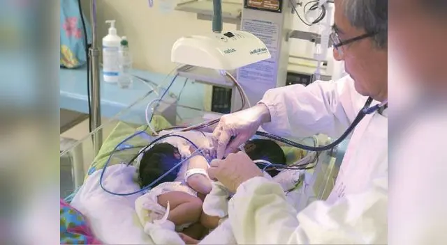 Siamesas se encuentran recuperándose tras exitosa operación Siamesas se encuentran recuperándose tras exitosa operación