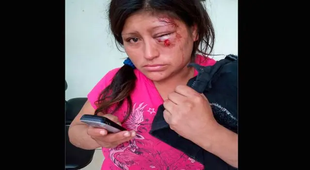 Mujer se arrepintió de denuncia y quiso retirarla
