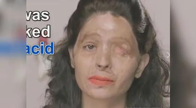 Reshma Banoo sufrió el terrible ataque a los 17 años 