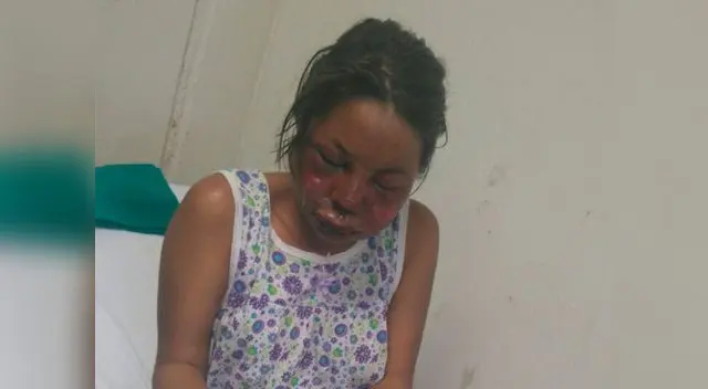 Fiscal pide nueve meses de prisión preventiva para sereno agresor Carlos Feijoó