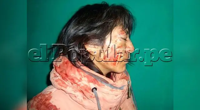 Policía captura a fiscal Luis Rodolfo Añamuro Machicao por golpear salvajemente a su esposa