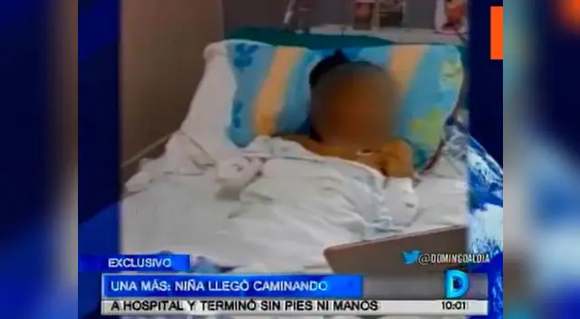 Infortunada menor sufre por amputación de manos y pies en EsSalud