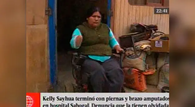 Intenta suicidarse tras perder sus extremidades por supuesta negligencia de EsSalud