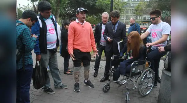 Uno hombre le muestra sus prótesis a Shirley