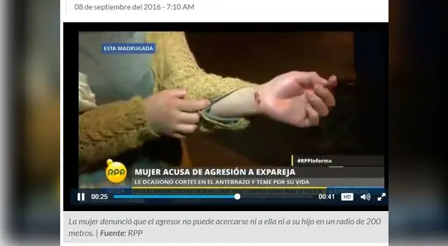 Agraviada muestra herida sufrida Agraviada muestra herida sufrida