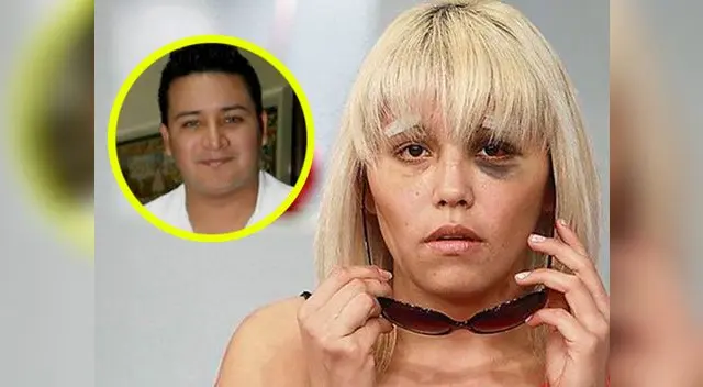 Lady Guillén sufrió mucho tras agresiones de Rony García