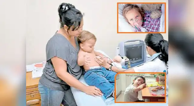 Una cirugía para tratar mal puede superar los 100 mil soles Una cirugía para tratar mal puede superar los 100 mil soles