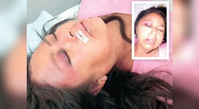 El hombre llegó de madrugada ebrio y atacó a la mujer