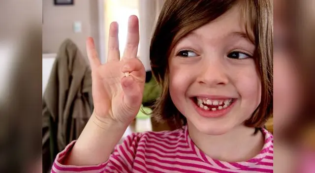 Conoce la forma correcta de retirar un diente de leche a tu hijo