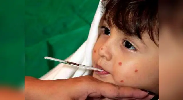 Para el tratamiento de la fiebre se debe usar exclusivamente paracetamol. Para el tratamiento de la fiebre se debe usar exclusivamente paracetamol.