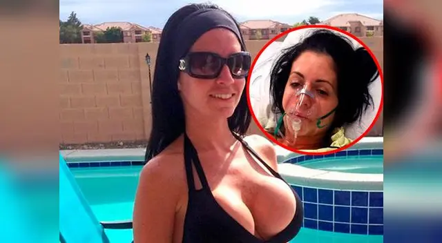 La hermosa mujer terminó en un grave estado a punto de morir 