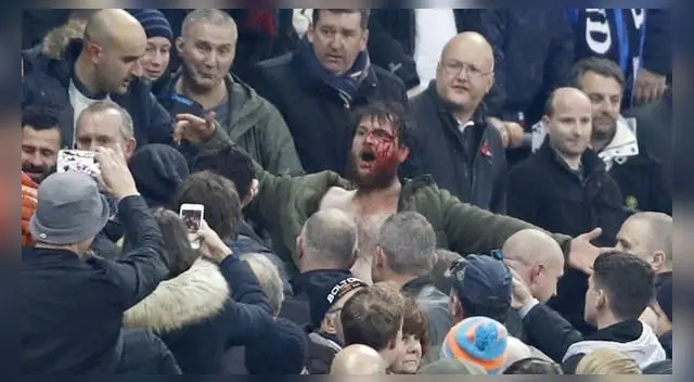 Este hincha fue brutalmente agredido Este hincha fue brutalmente agredido