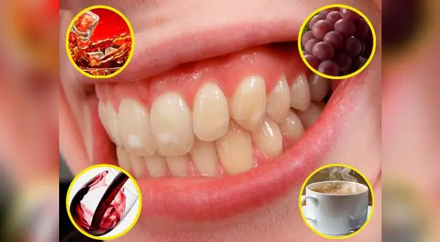 Deja de comer estos alimentos para evitar el color amarillo en ellos