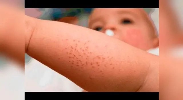 A cuidar la piel de los más pequeños en estos días de calor