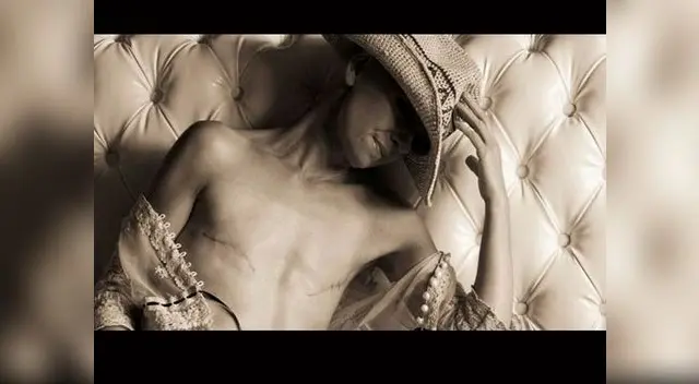 Fotógrafa le da un valiente mensaje a mujeres que pasaron por una mastectomía