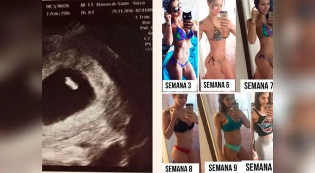 Xoana González perdió bebe de pocas semanas Xoana González perdió bebe de pocas semanas