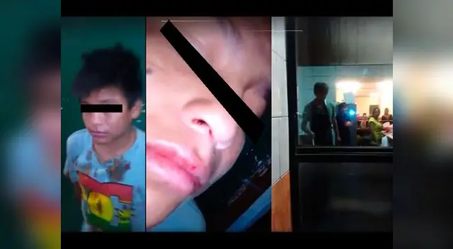 Niño de 8 años fue agredido por dueño de un chifa solo por pedir comida y limosna