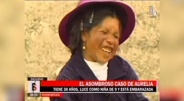 Mujer de 38 años luce como niña de 9 y está embarazada en Huancavelica