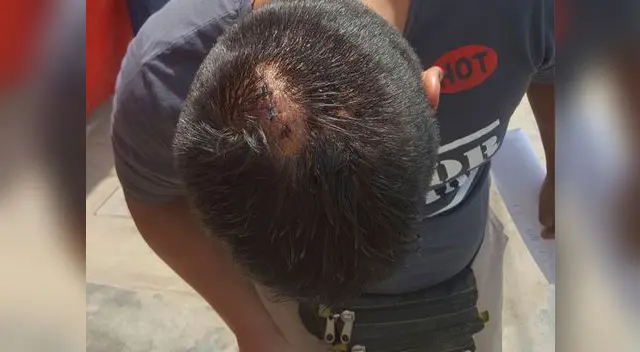Cinco puntos le aplicaron en la cabeza para suturarle la herida