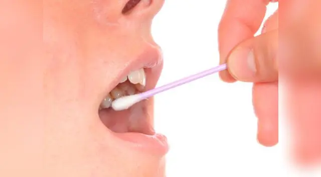 Te sorprenderás, todo lo que pueden hallar en un análisis de saliva Te sorprenderás, todo lo que pueden hallar en un análisis de saliva