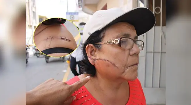 Así quedó el rostro de madre de familia tras feroz ataque de su esposo. Así quedó el rostro de madre de familia tras feroz ataque de su esposo.