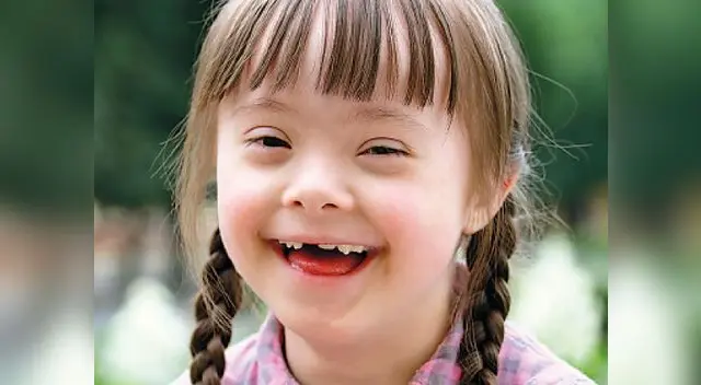 El 21 de marzo se celebra el Día Mundial del Síndrome de Down.