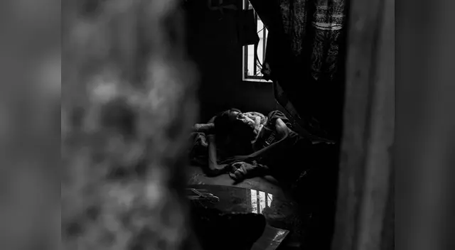 En el Día Mundial de la Tuberculosis, Perú aún tiene pacientes graves por TBC 