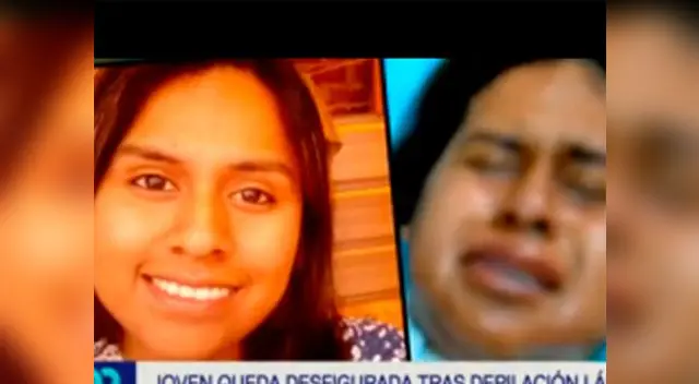 Joven llora al ver que los resultados de la depilación láser no fueron los esparados Joven llora al ver que los resultados de la depilación láser no fueron los esparados