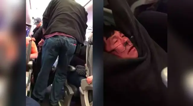 Así quedó pasajero de United Airlines tras sufrir paliza
