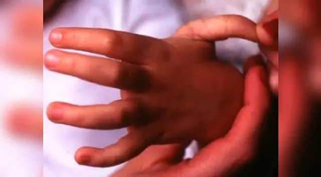 Niños que se agotan con tareas de colegio podrían tener síndrome de hiperlaxitud Niños que se agotan con tareas de colegio podrían tener síndrome de hiperlaxitud