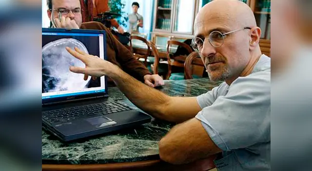Sergio Canavero revolucionará la medicina con el primer trasplante de cabeza