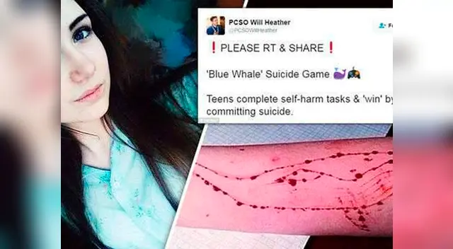 La 'ballena azul', el reto que pide a los participantes que se autolesionen y atenten contra su vida La 'ballena azul', el reto que pide a los participantes que se autolesionen y atenten contra su vida