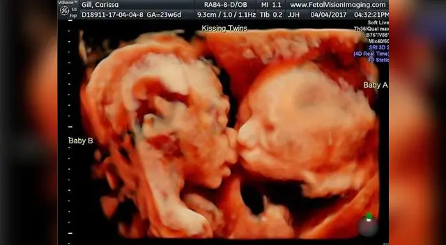 La tierna imagen de Isabella y Gil ya dio la vuelta al mundo