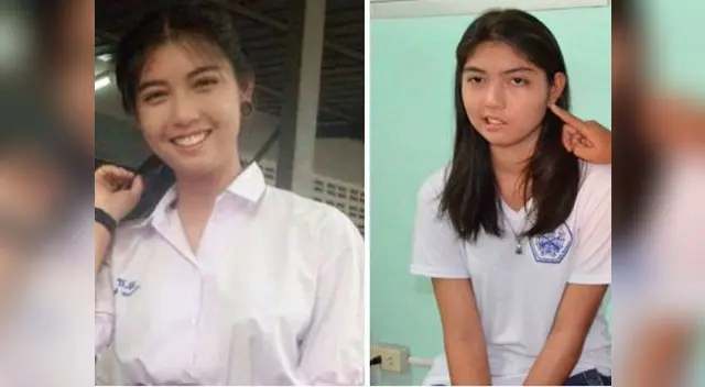 Joven sufrió parálisis facial luego que su profesor le lanzara una taza en el rostro Joven sufrió parálisis facial luego que su profesor le lanzara una taza en el rostro