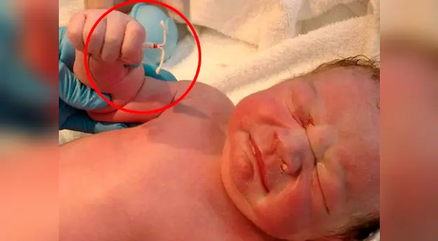 El bebé se negó a la ciencia y vivió para hacer historia El bebé se negó a la ciencia y vivió para hacer historia