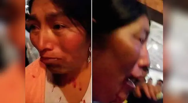 Mujer fue agredida en Rústica Mujer fue agredida en Rústica