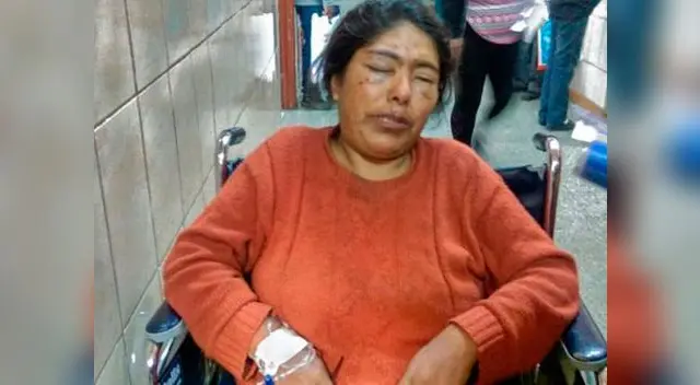 Poder Judicial de Arequipa dictó 4 meses de prisión preventiva contra reciclador que atacó a mujer con un taladro